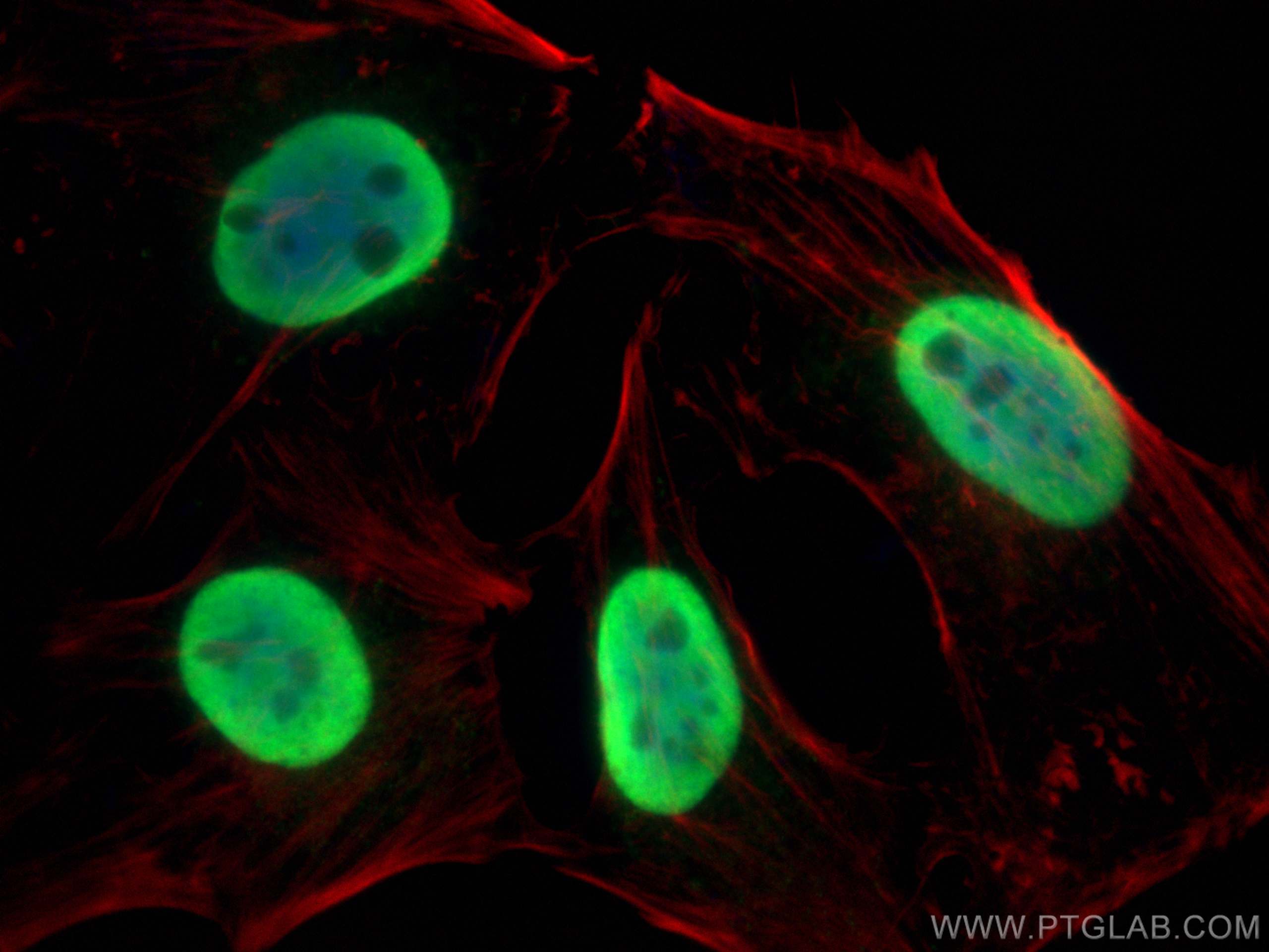 Immunofluorescence (IF) / fluorescent staining of HeLa cells using XRCC5/Ku80 Polyclonal antibody (16389-1-AP)