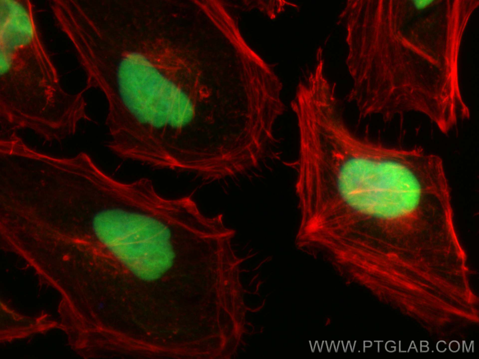 Immunofluorescence (IF) / fluorescent staining of HeLa cells using XRCC5 Monoclonal antibody (66546-1-Ig)
