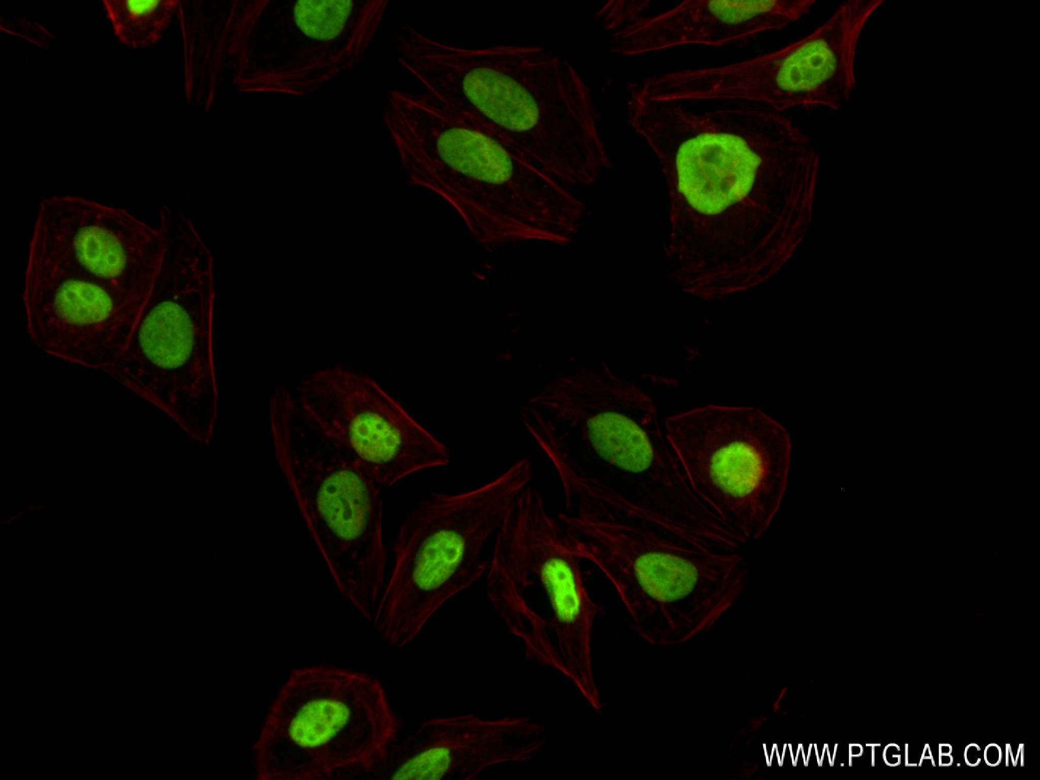 Immunofluorescence (IF) / fluorescent staining of HepG2 cells using XRCC5 Recombinant antibody (80325-6-RR)