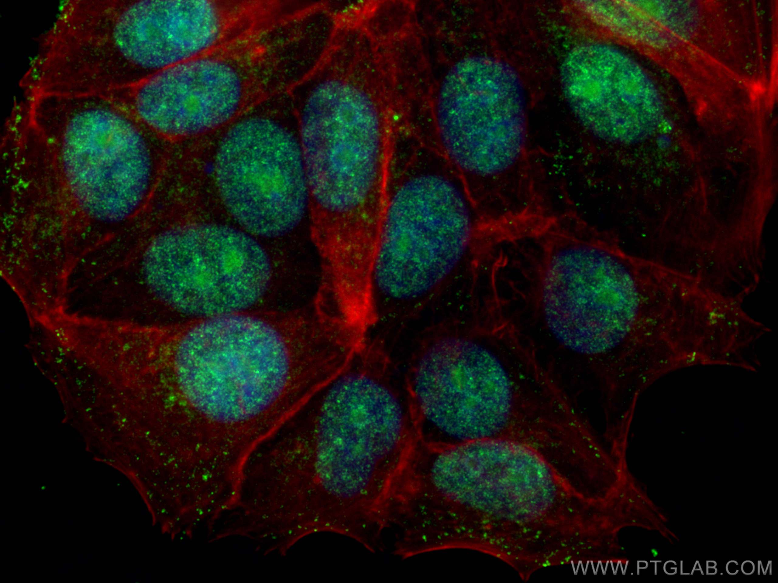 Immunofluorescence (IF) / fluorescent staining of MCF-7 cells using XRN2 Monoclonal antibody (66852-1-Ig)