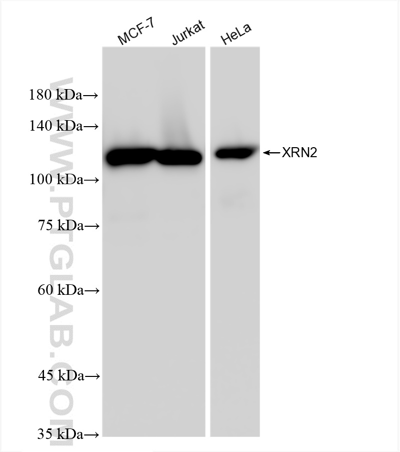 Western Blot (WB) analysis of various lysates using XRN2 Recombinant antibody (83378-1-RR)
