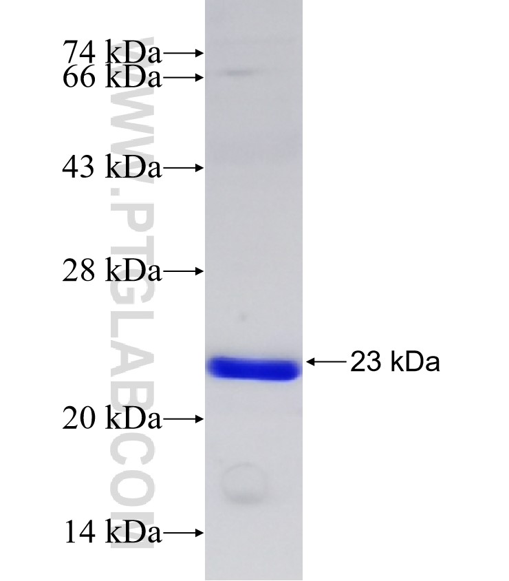 XRN2 fusion protein Ag30781 SDS-PAGE