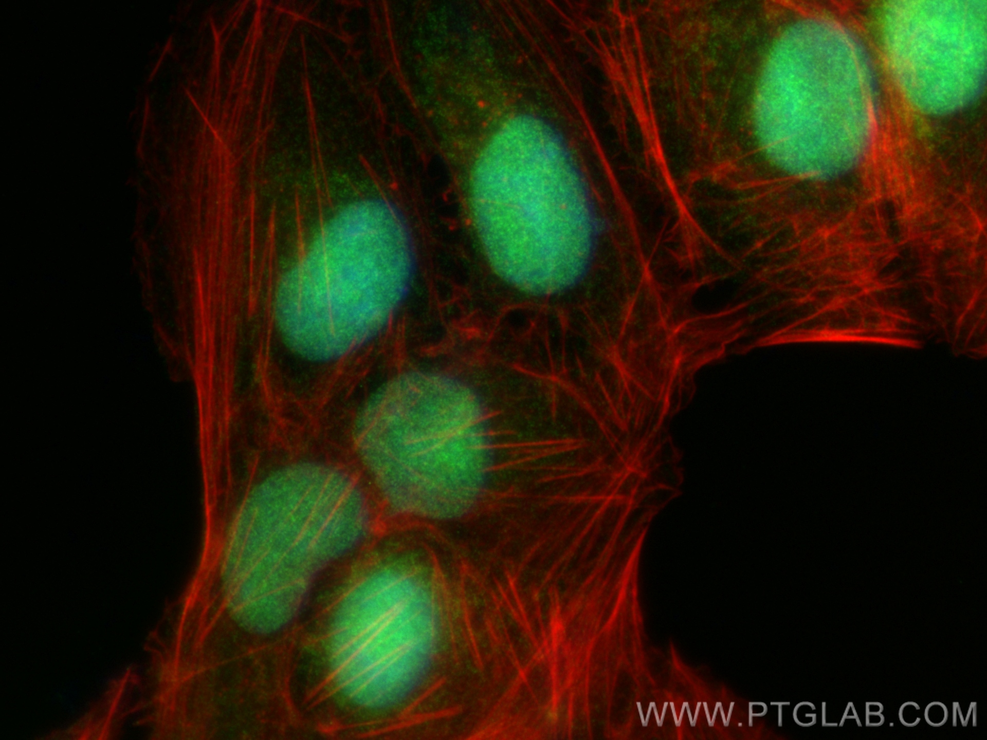 Immunofluorescence (IF) / fluorescent staining of U2OS cells using YAF2 Polyclonal antibody (13980-1-AP)