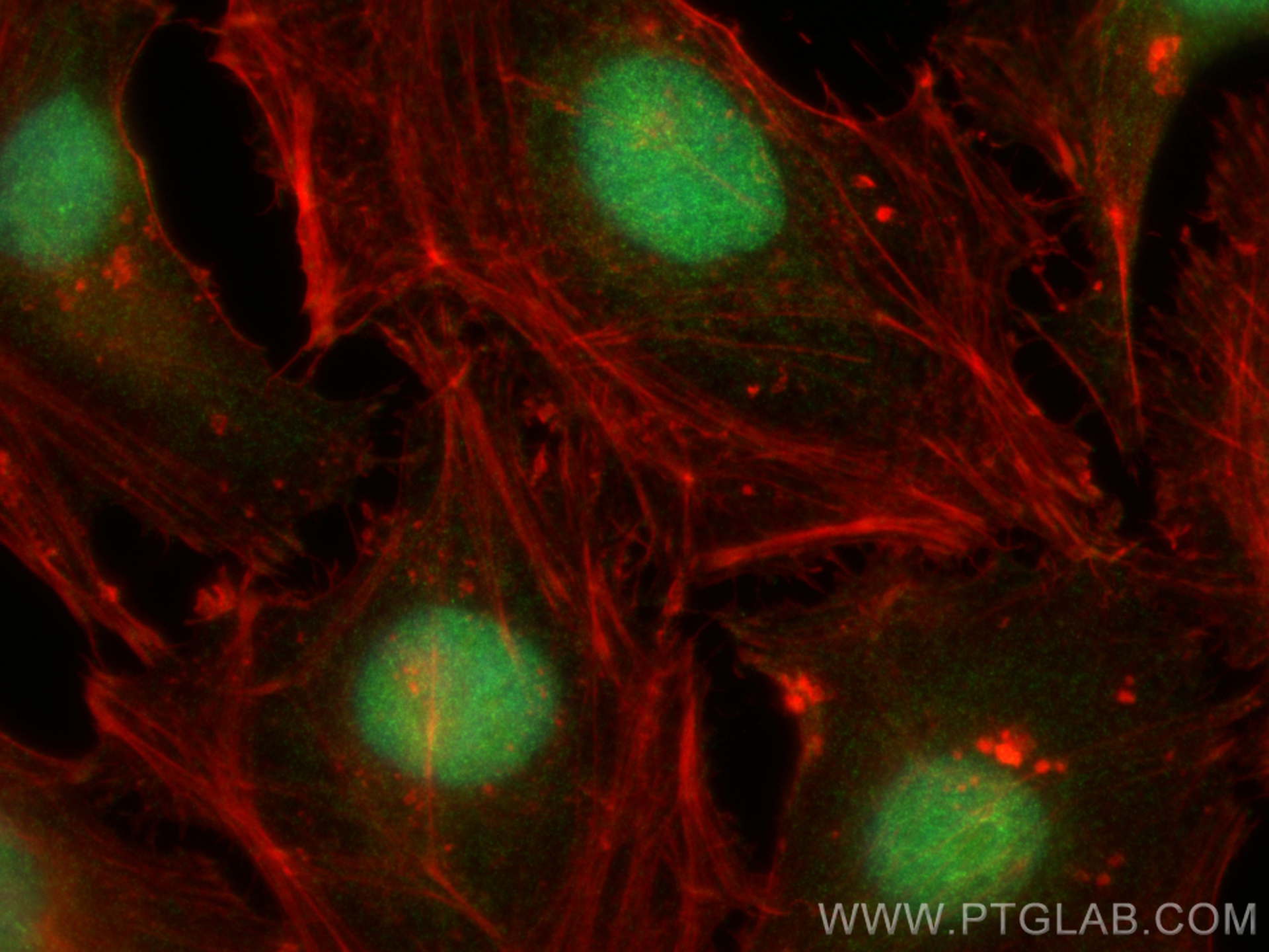 Immunofluorescence (IF) / fluorescent staining of HeLa cells using YAF2 Polyclonal antibody (13980-1-AP)