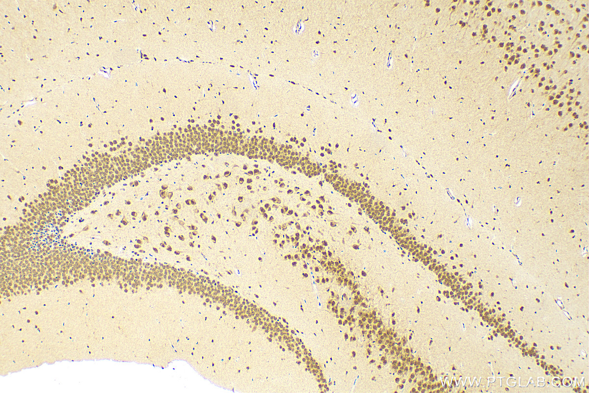 Immunohistochemistry (IHC) staining of mouse brain tissue using YAF2 Polyclonal antibody (13980-1-AP)