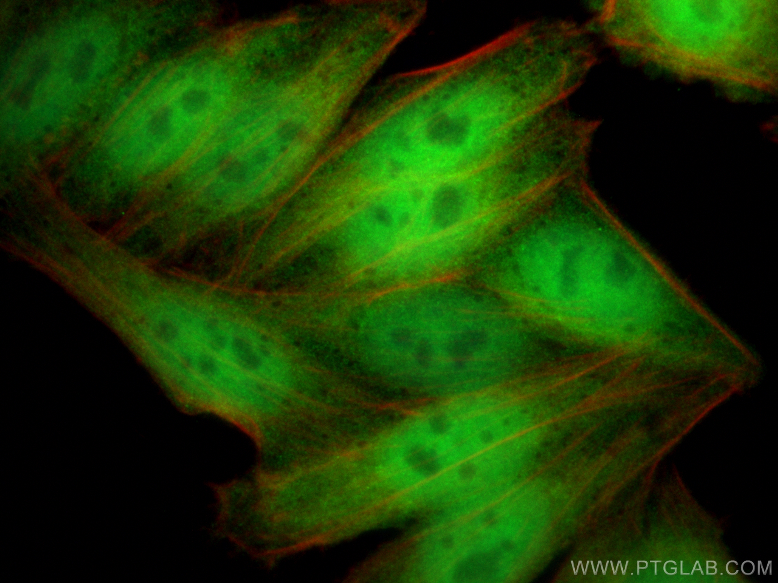 Immunofluorescence (IF) / fluorescent staining of HepG2 cells using YAP1 Monoclonal antibody (66900-1-Ig)