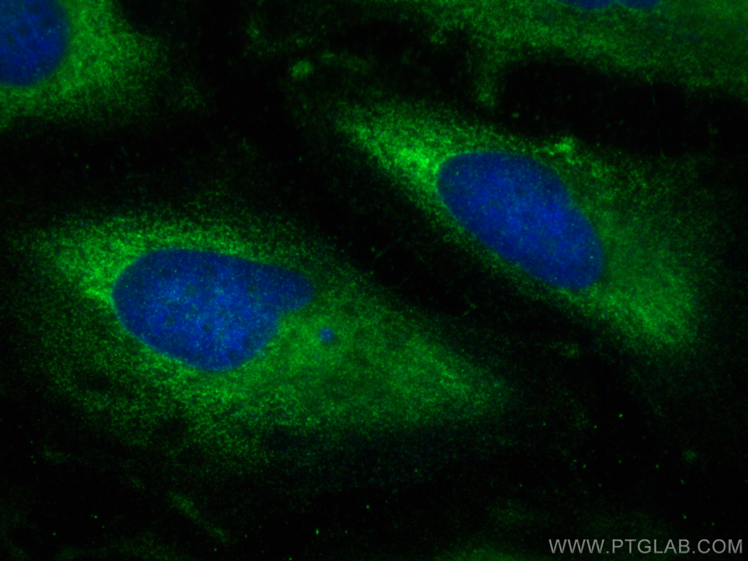 Immunofluorescence (IF) / fluorescent staining of HeLa cells using YBX1 Polyclonal antibody (20339-1-AP)