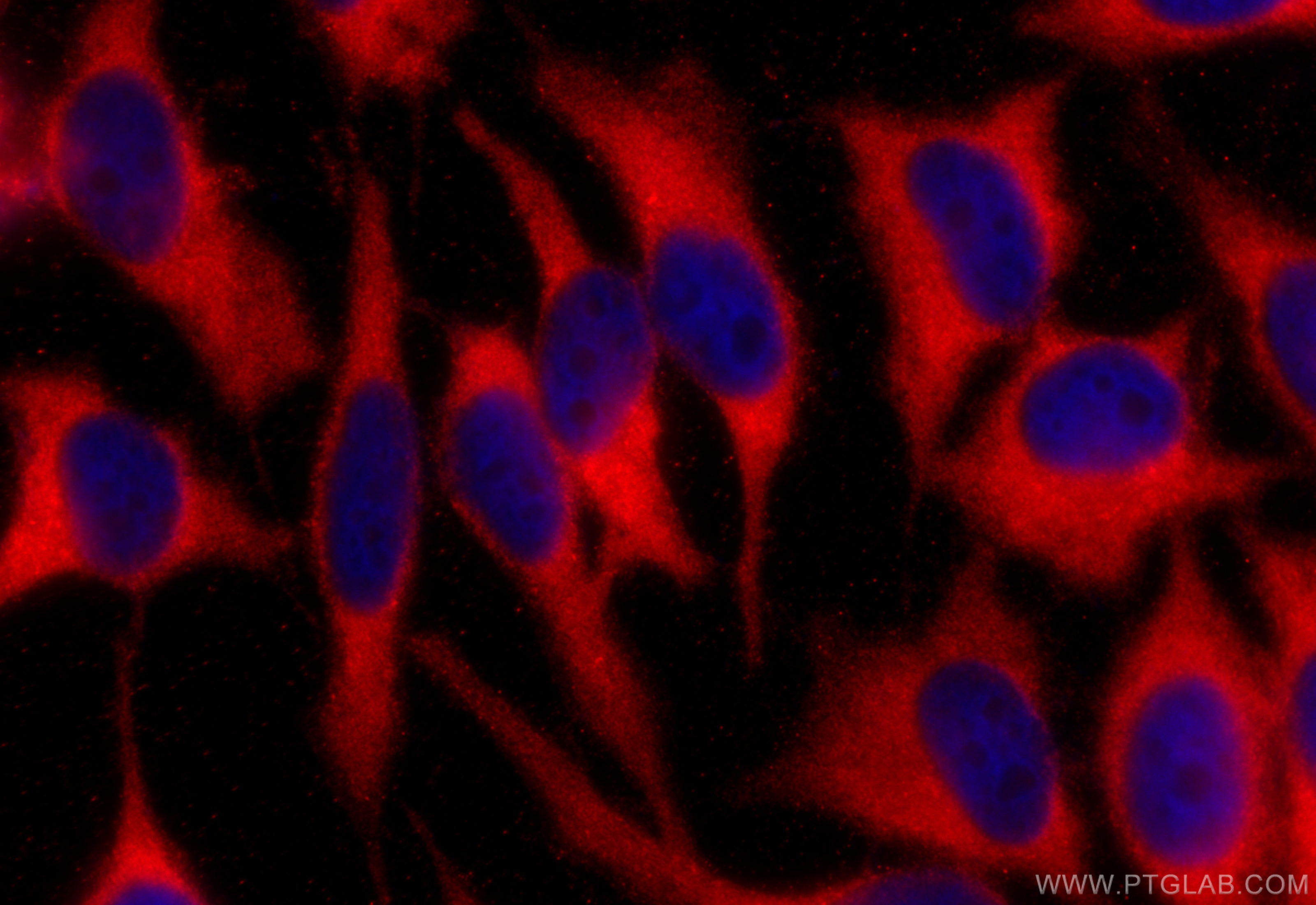 Immunofluorescence (IF) / fluorescent staining of HeLa cells using YBX1 Polyclonal antibody (20339-1-AP)