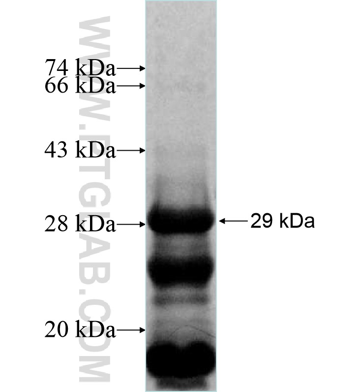 YBX1 Fusion Protein - United Bio Research