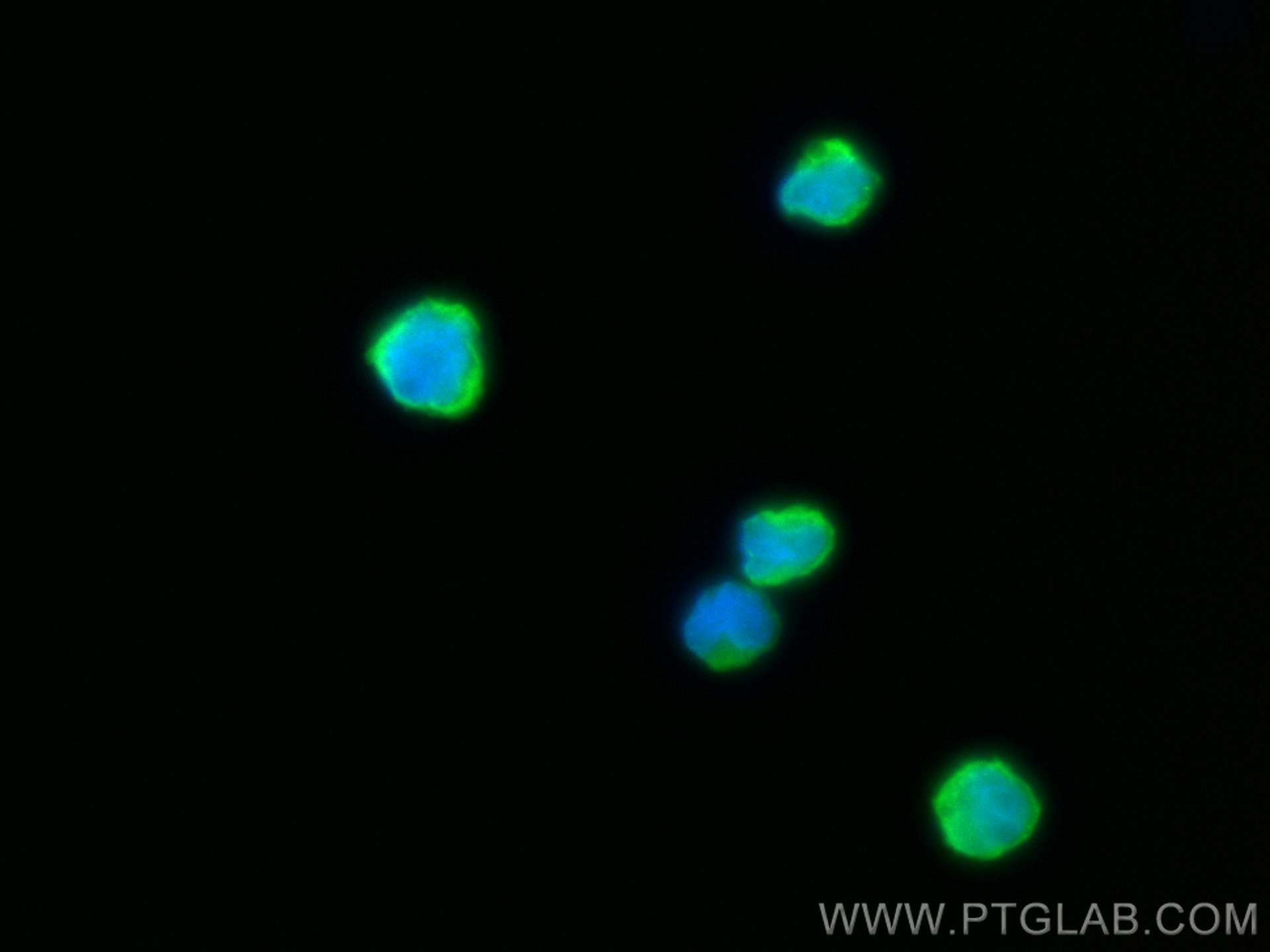 Immunofluorescence (IF) / fluorescent staining of Raji cells using CoraLite® Plus 488-conjugated CD20 Monoclonal anti (CL488-60271)