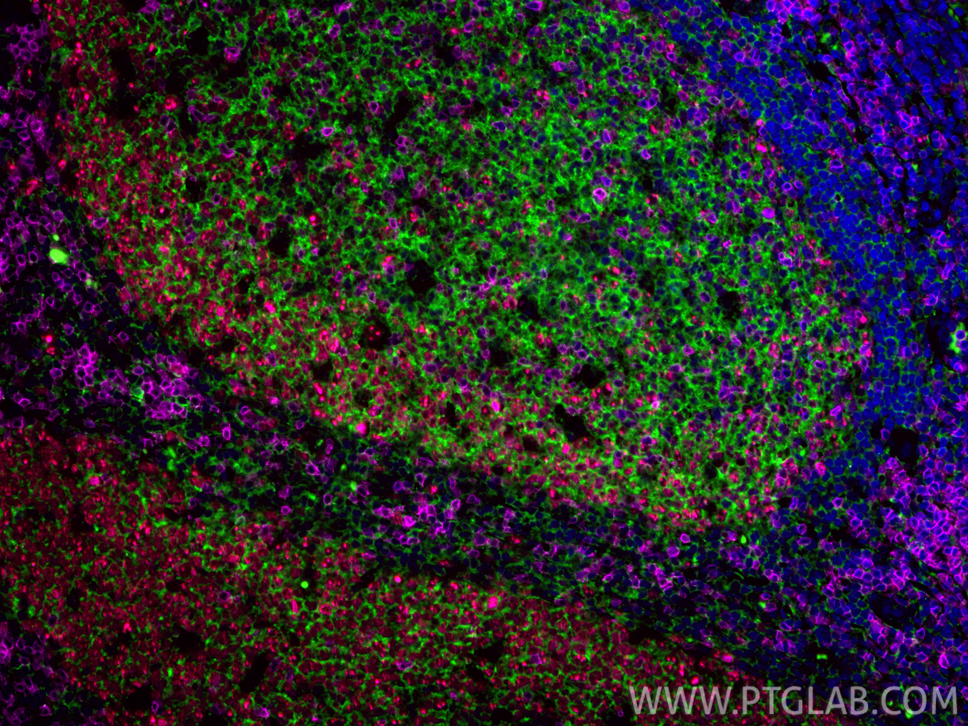 Immunofluorescence (IF) / fluorescent staining of human tonsillitis tissue using CoraLite® Plus 488-conjugated CD20 Monoclonal anti (CL488-60271)