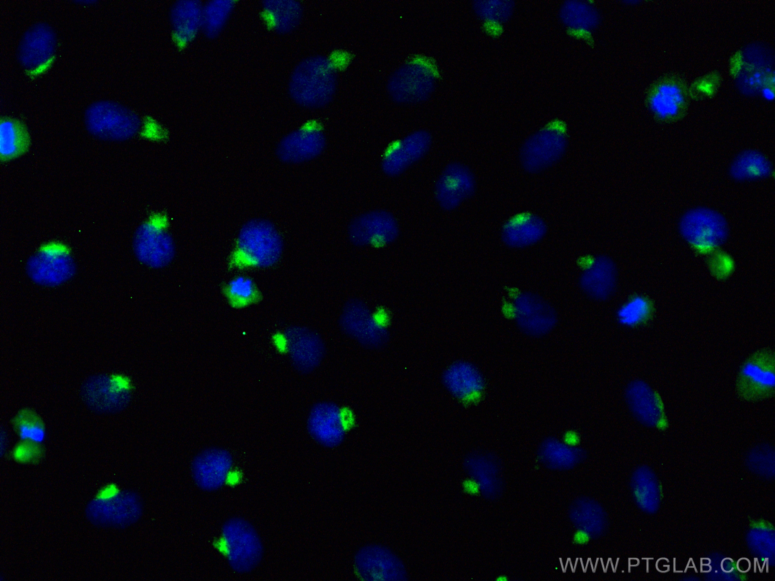 Immunofluorescence (IF) / fluorescent staining of HeLa cells using YIPF4 Polyclonal antibody (15473-1-AP)