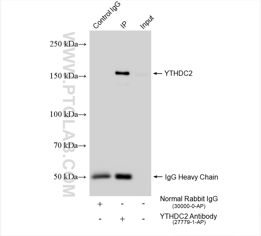 Immunoprecipitation (IP) experiment of HeLa cells using YTHDC2 Polyclonal antibody (27779-1-AP)