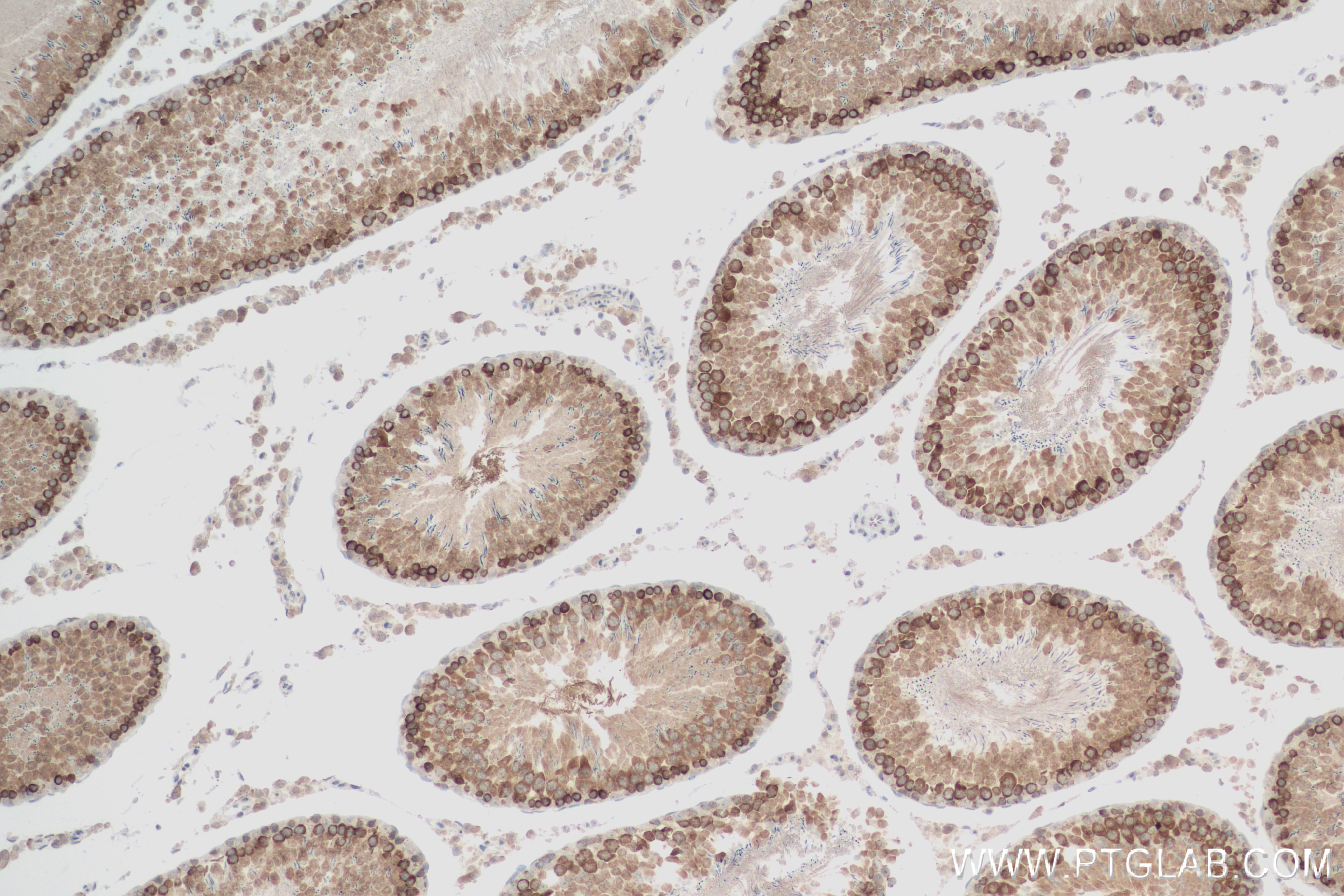 Immunohistochemistry (IHC) staining of rat testis tissue using YTHDC2 Recombinant antibody (83970-1-RR)