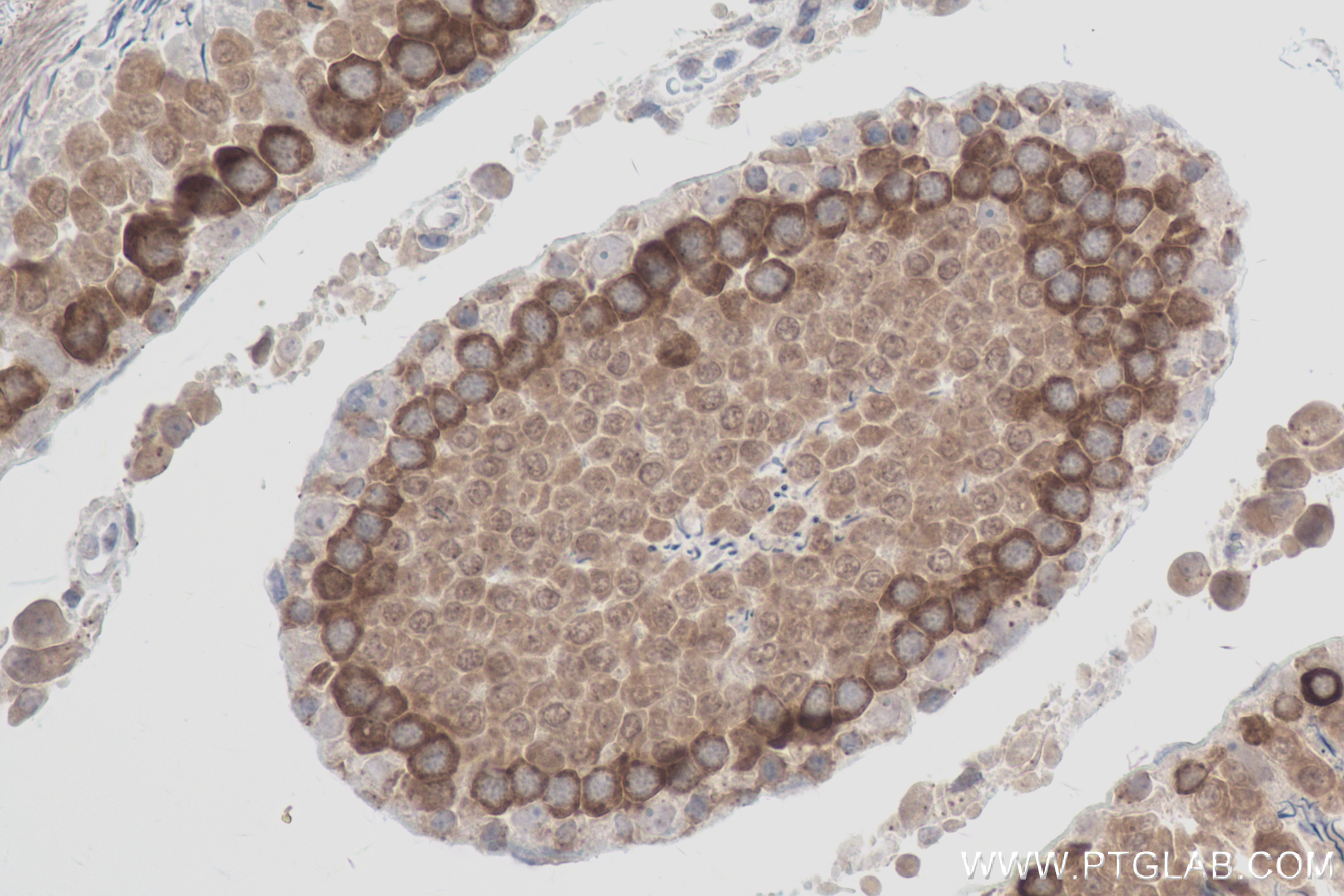 Immunohistochemistry (IHC) staining of rat testis tissue using YTHDC2 Recombinant antibody (83970-1-RR)