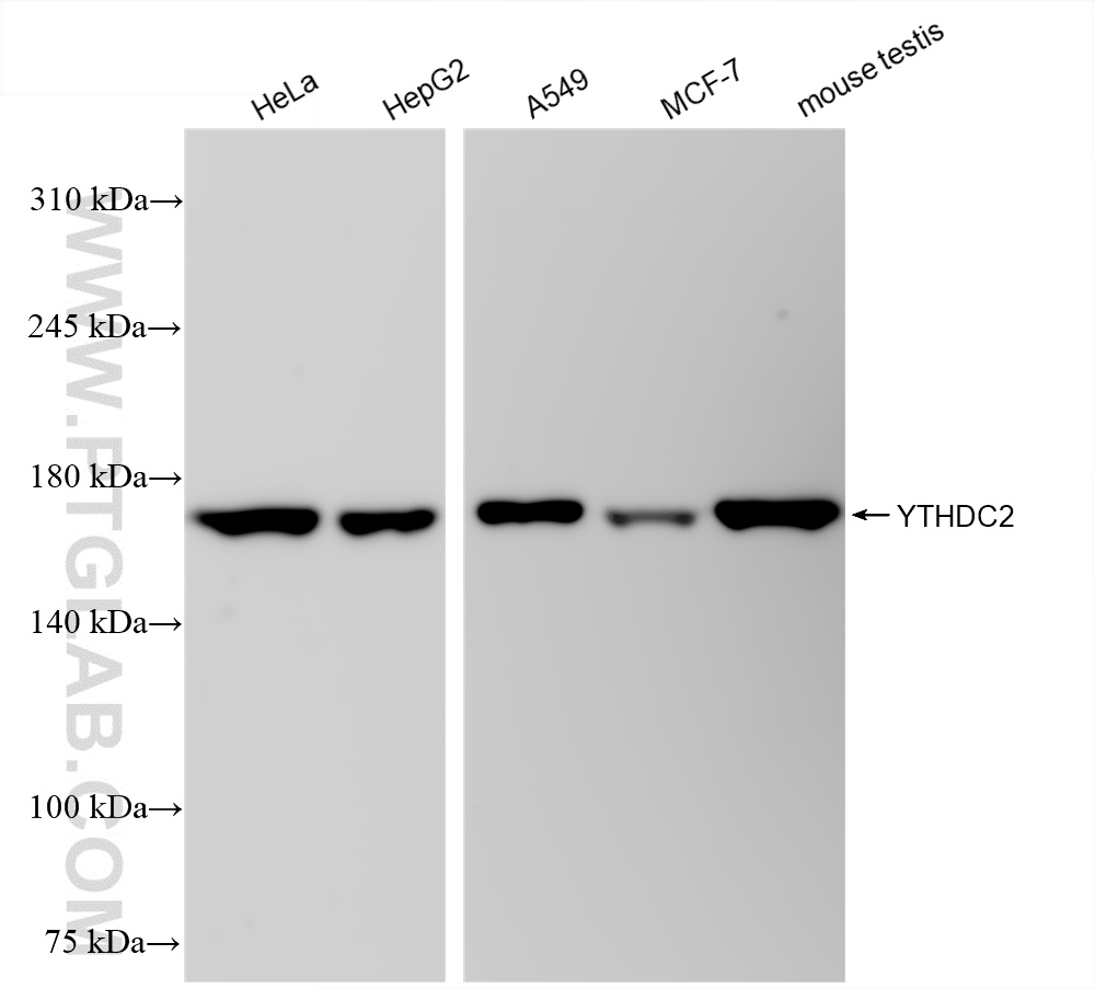 Western Blot (WB) analysis of various lysates using YTHDC2 Recombinant antibody (83970-1-RR)