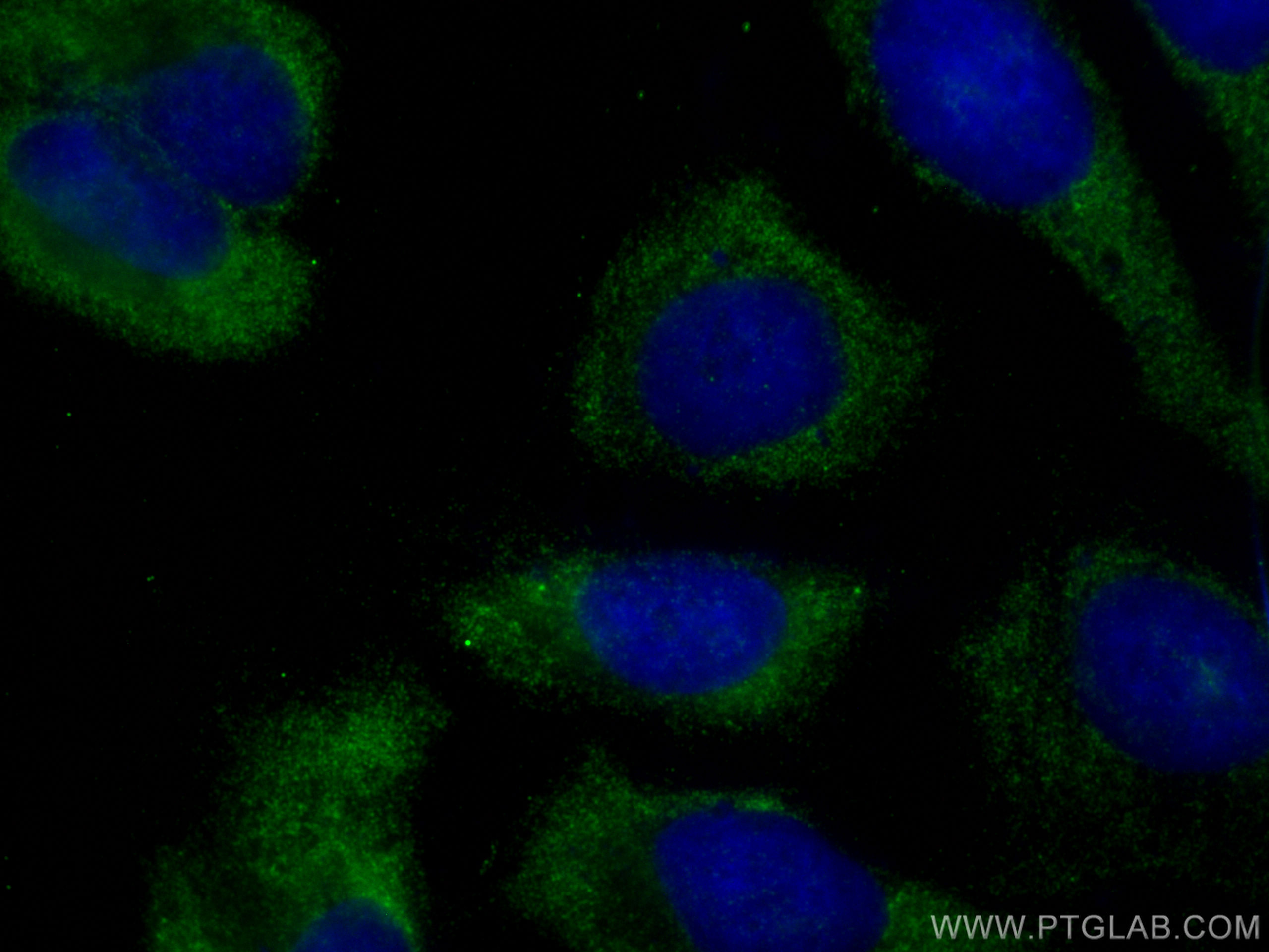 Immunofluorescence (IF) / fluorescent staining of U2OS cells using YTHDF1 Polyclonal antibody (17479-1-AP)