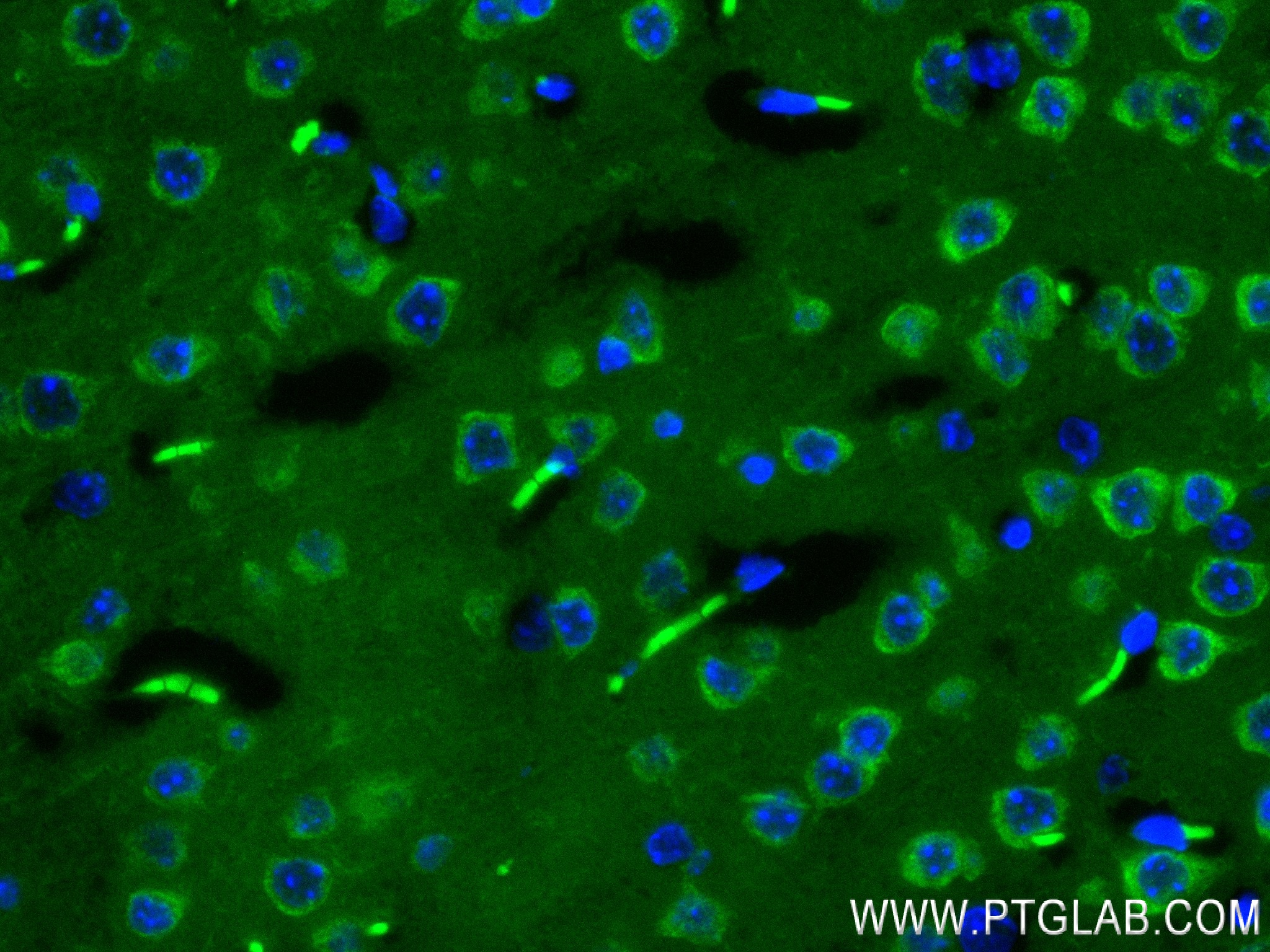 Immunofluorescence (IF) / fluorescent staining of mouse brain tissue using YTHDF1 Recombinant antibody (80876-2-RR)