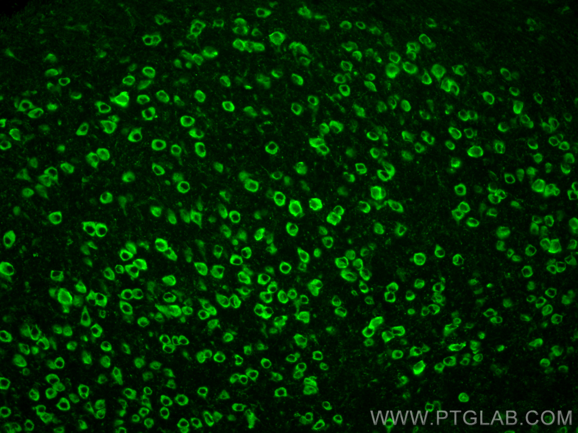 Immunofluorescence (IF) / fluorescent staining of mouse brain tissue using YTHDF2 Polyclonal antibody (24744-1-AP)