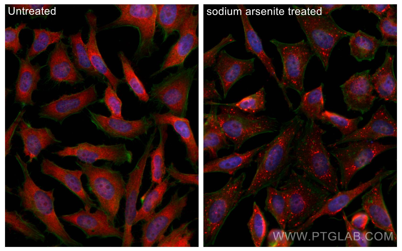 Immunofluorescence (IF) / fluorescent staining of HeLa cells using YTHDF2 Polyclonal antibody (24744-1-AP)