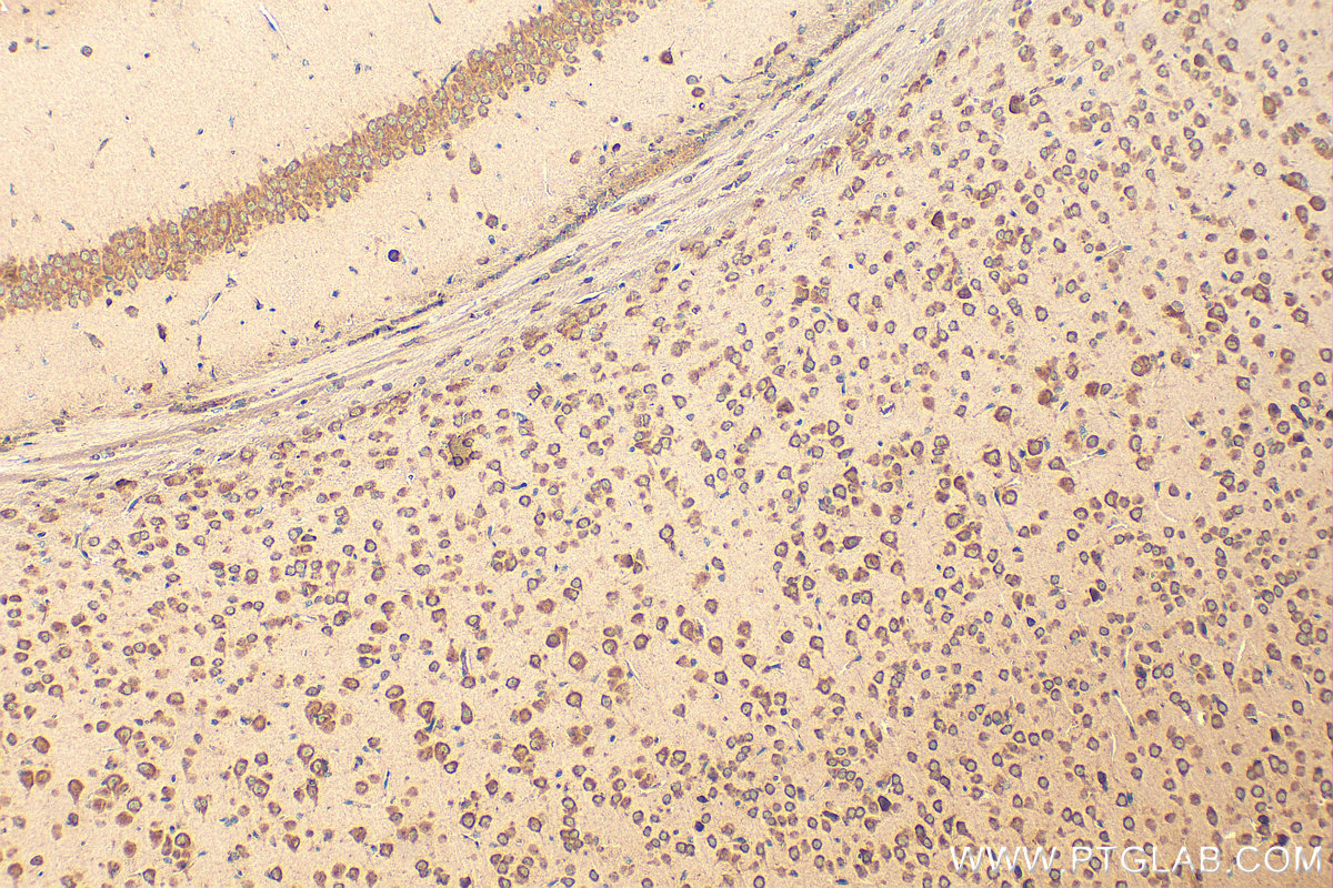 Immunohistochemistry (IHC) staining of mouse brain tissue using YTHDF2 Polyclonal antibody (24744-1-AP)