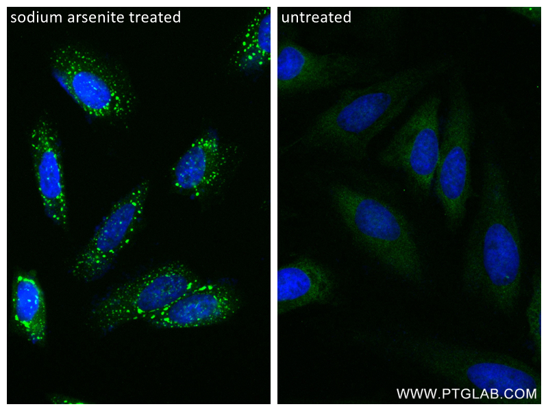 Immunofluorescence (IF) / fluorescent staining of HeLa cells using YTHDF2 Recombinant antibody (81340-1-RR)