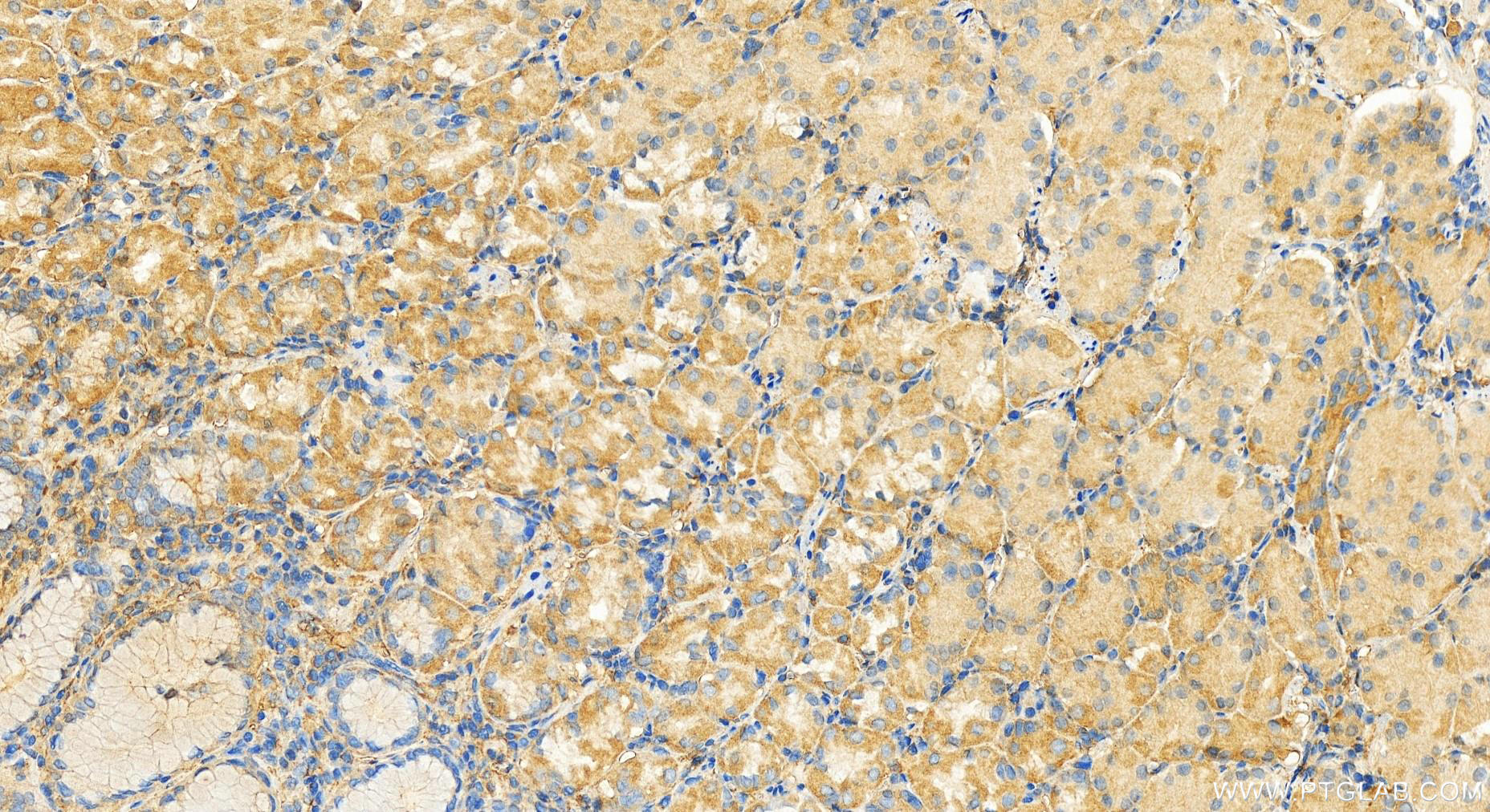 Immunohistochemistry (IHC) staining of human stomach tissue using YWHAH Polyclonal antibody (15222-1-AP)