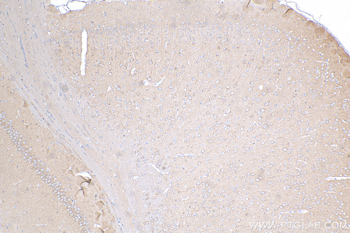 Immunohistochemistry (IHC) staining of mouse brain tissue using YWHAH Polyclonal antibody (15222-1-AP)