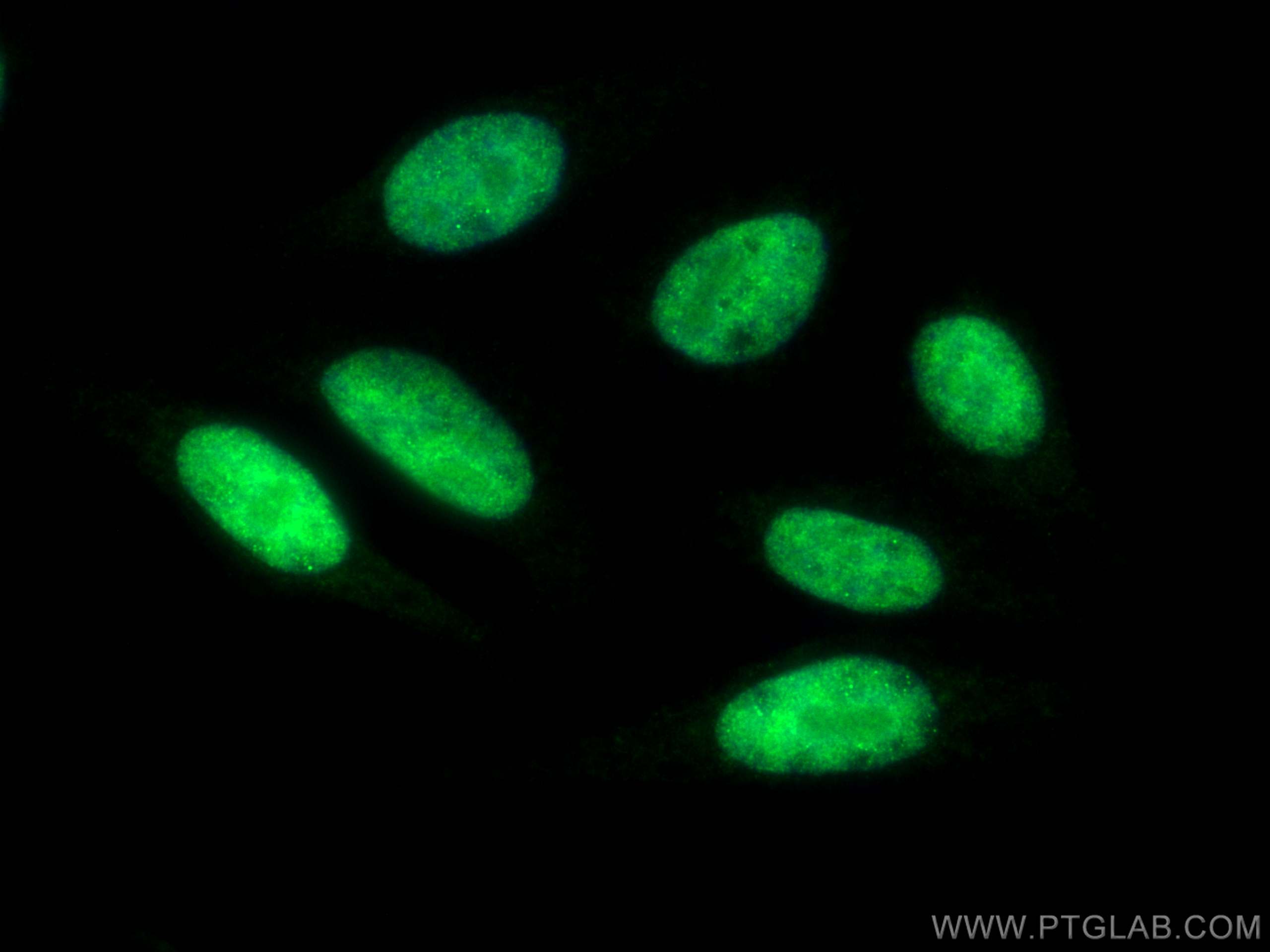 Immunofluorescence (IF) / fluorescent staining of HepG2 cells using YY1 Recombinant antibody (82712-5-RR)