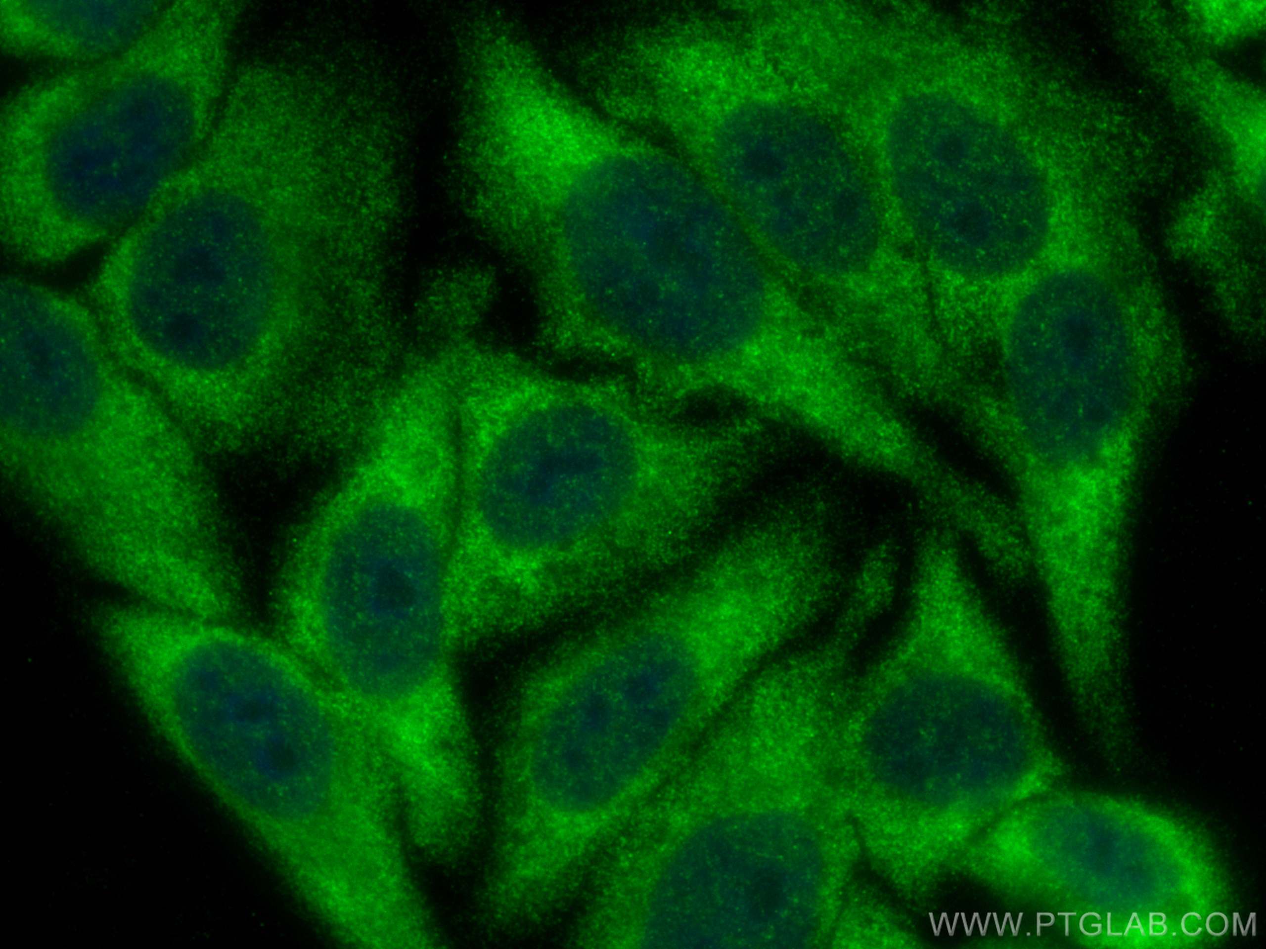 Immunofluorescence (IF) / fluorescent staining of HepG2 cells using ZAK Polyclonal antibody (14945-1-AP)