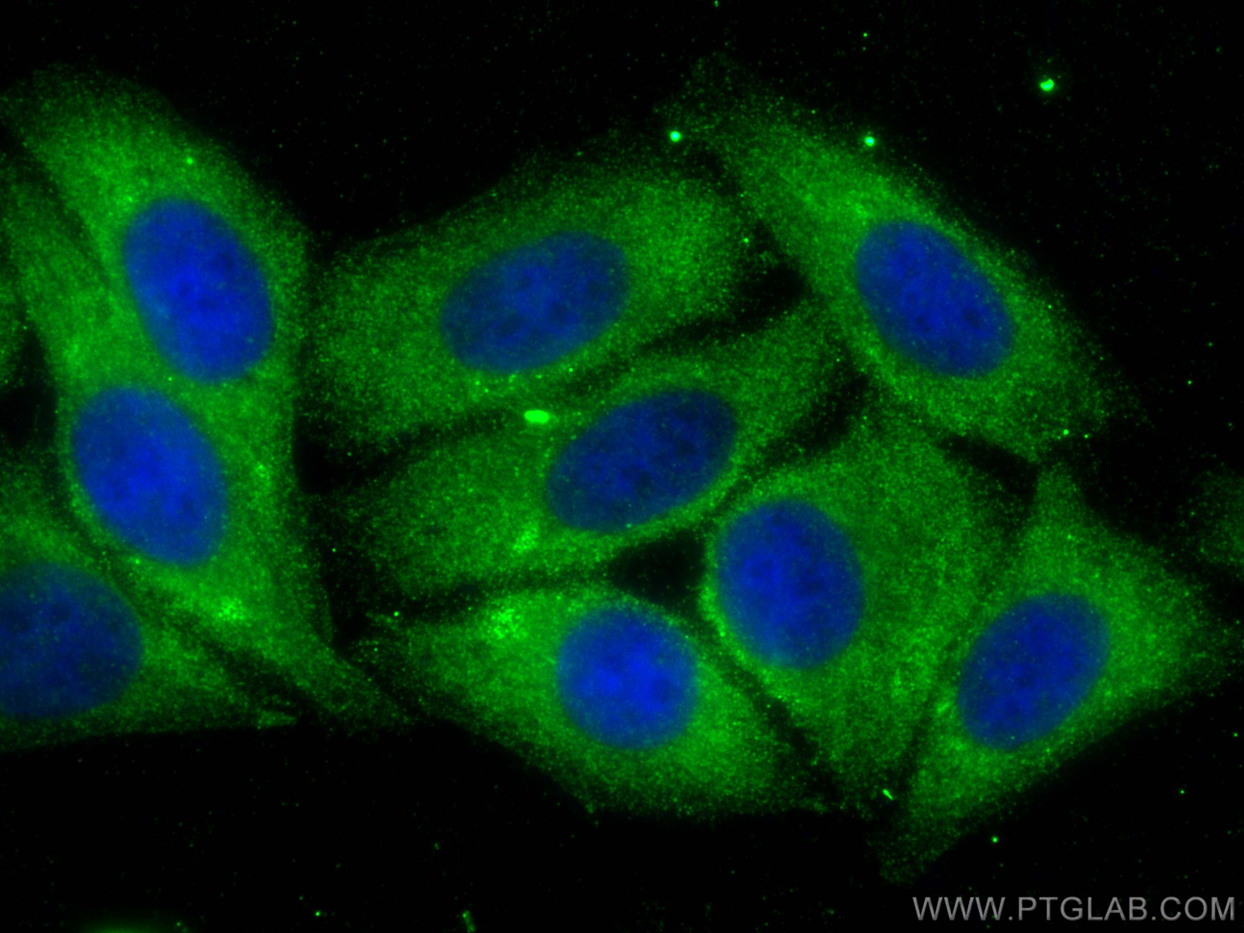 Immunofluorescence (IF) / fluorescent staining of HepG2 cells using ZAK Polyclonal antibody (28761-1-AP)