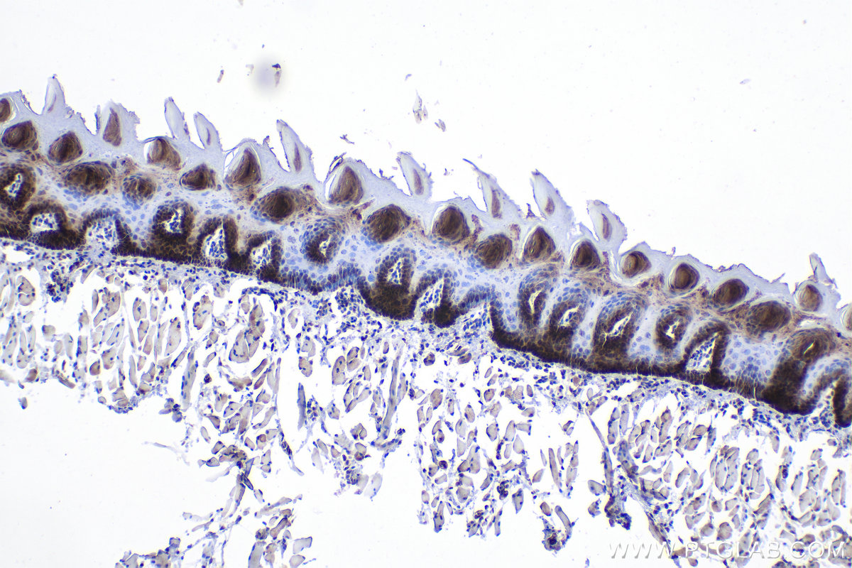 Immunohistochemistry (IHC) staining of rat tongue tissue using ZAK Polyclonal antibody (28761-1-AP)