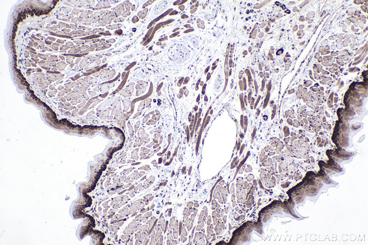 Immunohistochemistry (IHC) staining of mouse tongue tissue using ZAK Polyclonal antibody (28761-1-AP)