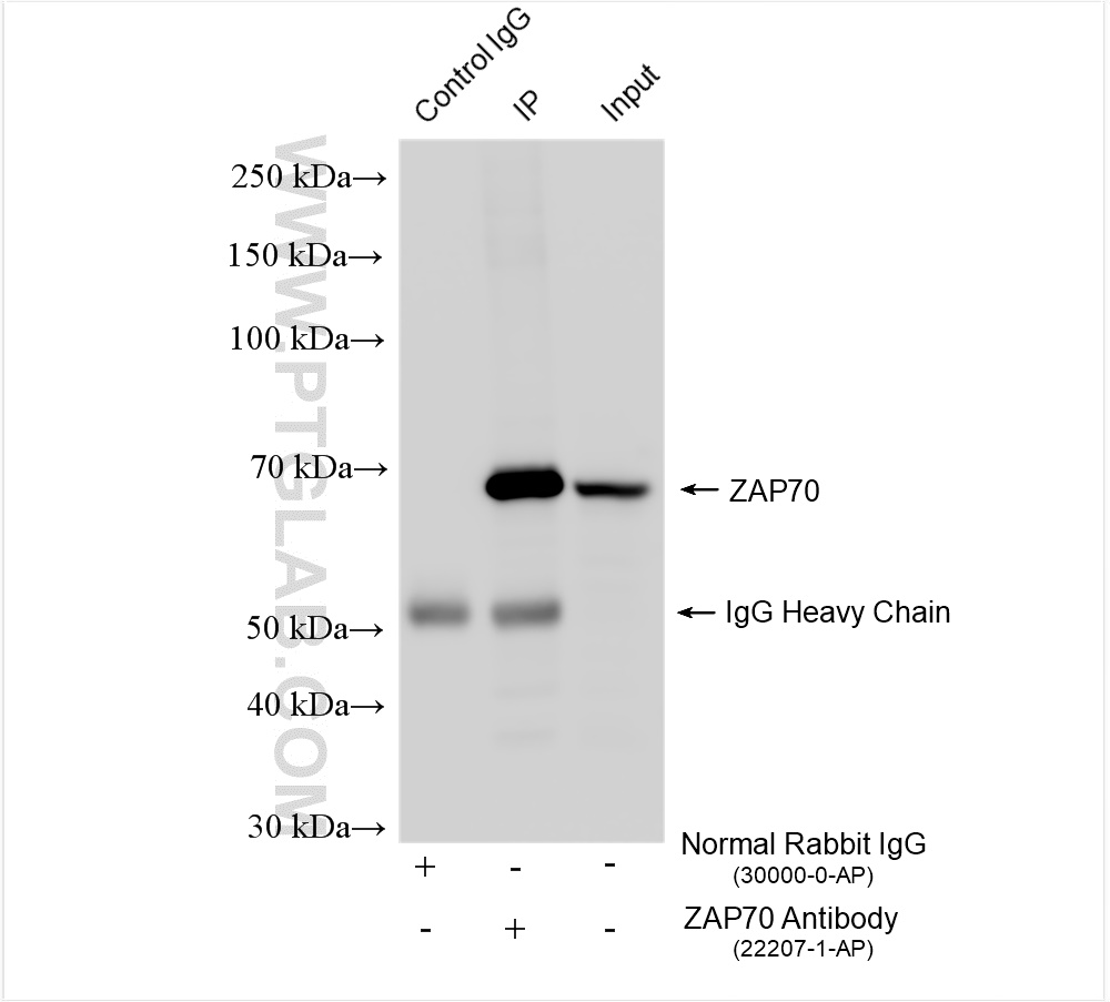 Immunoprecipitation (IP) experiment of Jurkat cells using ZAP70 Polyclonal antibody (22207-1-AP)