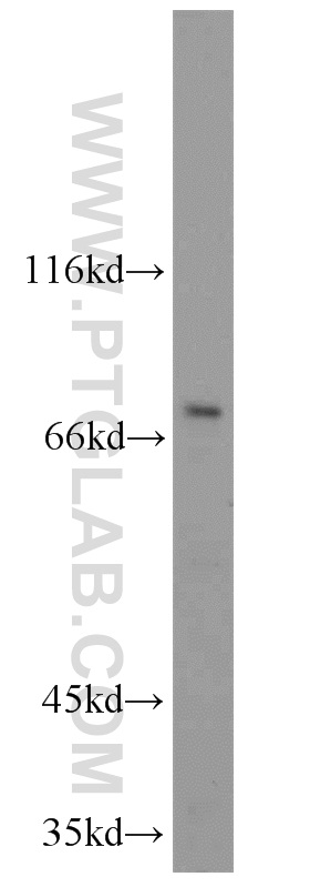 Western Blot (WB) analysis of RAW 264.7 cells using ZAP70 Polyclonal antibody (22207-1-AP)