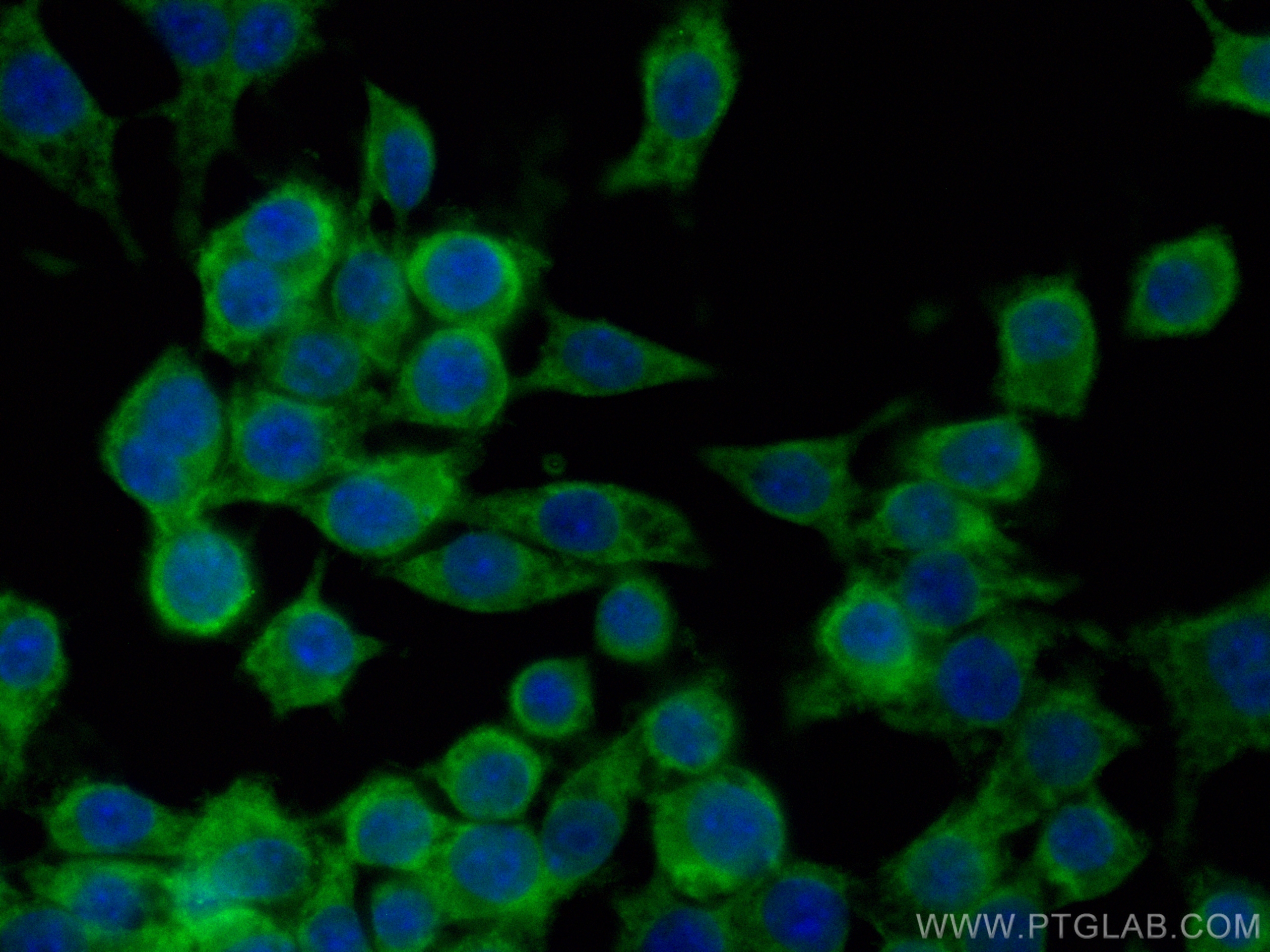 Immunofluorescence (IF) / fluorescent staining of RAW 264.7 cells using CoraLite® Plus 488-conjugated ZAP70 Polyclonal ant (CL488-15592)