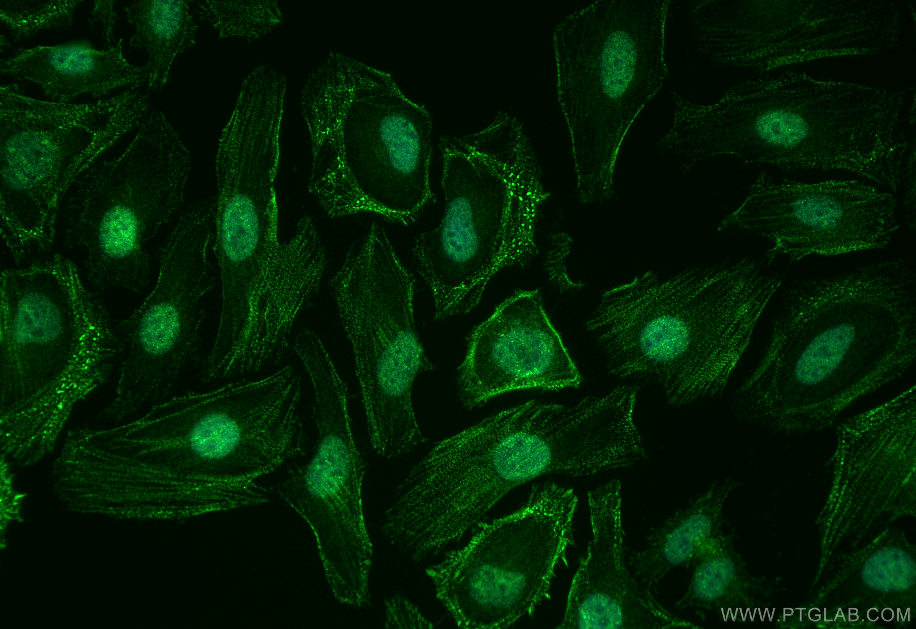 Immunofluorescence (IF) / fluorescent staining of HeLa cells using ZBP1 Polyclonal antibody (13285-1-AP)