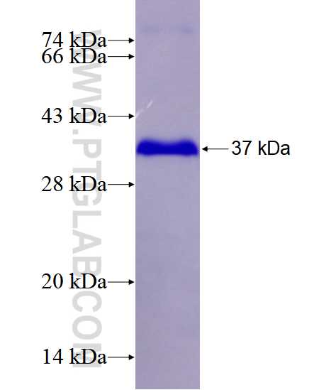 ZBTB16 fusion protein Ag28511 SDS-PAGE