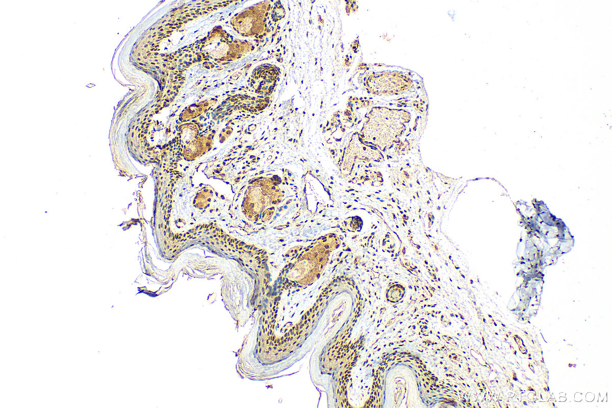 Immunohistochemistry (IHC) staining of mouse skin tissue using ZBTB46 Polyclonal antibody (25455-1-AP)