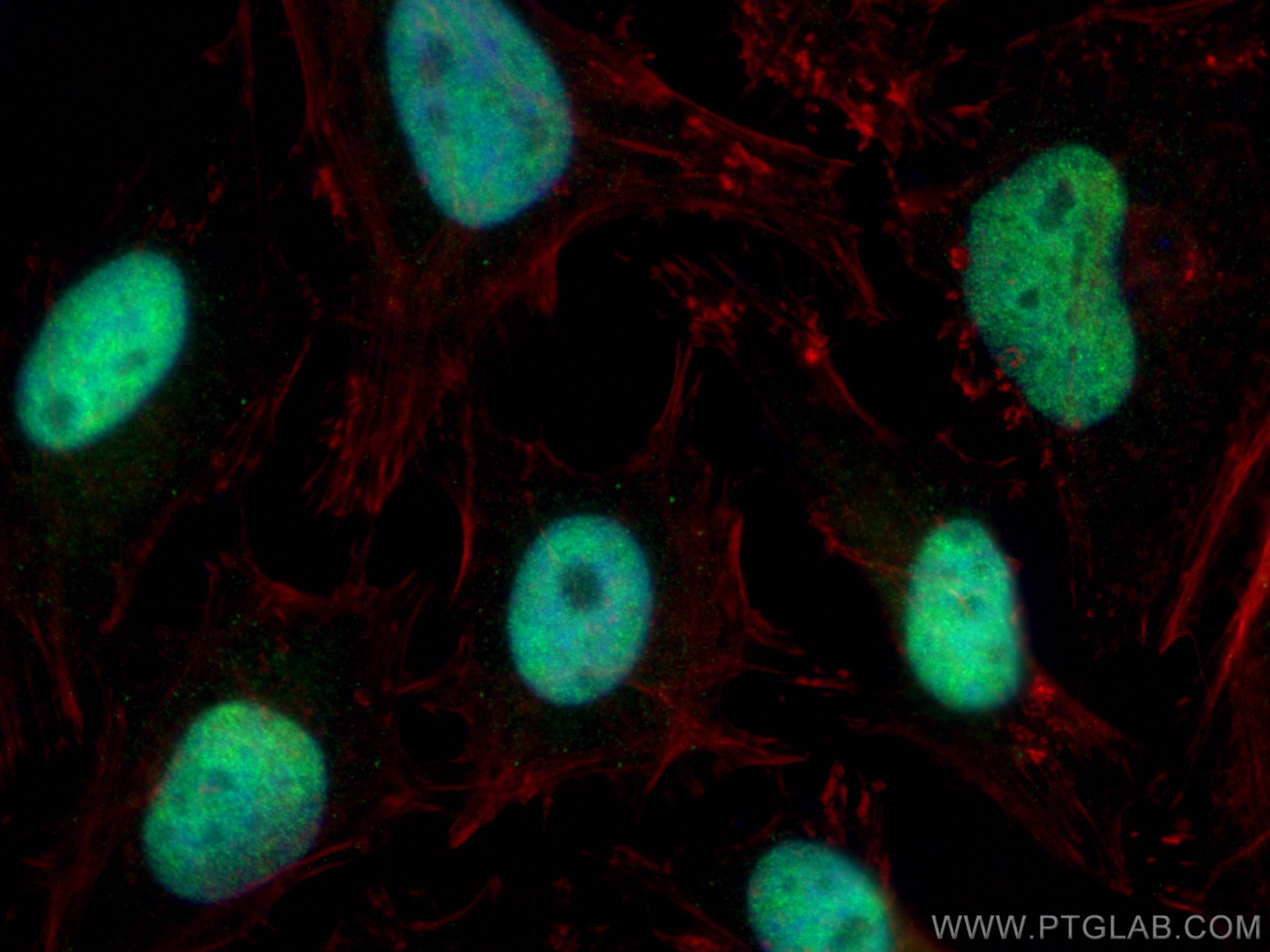 Immunofluorescence (IF) / fluorescent staining of HeLa cells using ZBTB7B Polyclonal antibody (11341-1-AP)