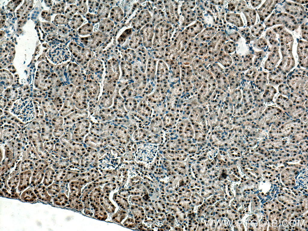 Immunohistochemistry (IHC) staining of mouse kidney tissue using ZBTB8OS Polyclonal antibody (28608-1-AP)