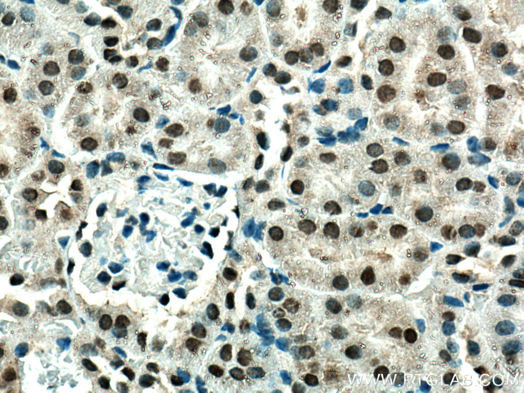 Immunohistochemistry (IHC) staining of mouse kidney tissue using ZBTB8OS Polyclonal antibody (28608-1-AP)