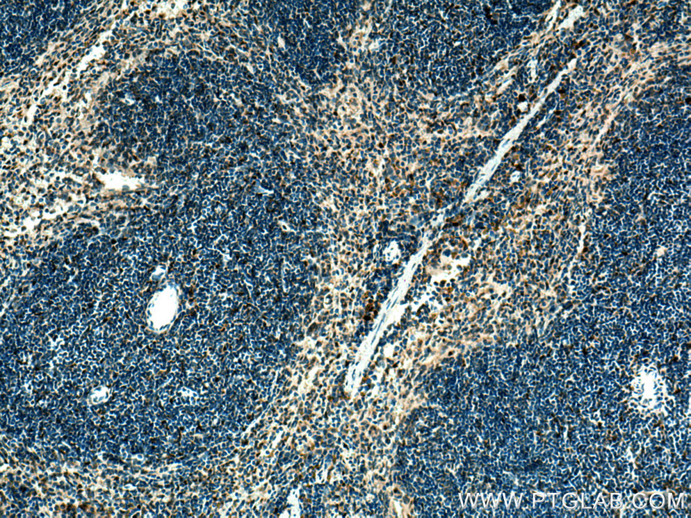 Immunohistochemistry (IHC) staining of mouse spleen tissue using ZBTB8OS Polyclonal antibody (28608-1-AP)