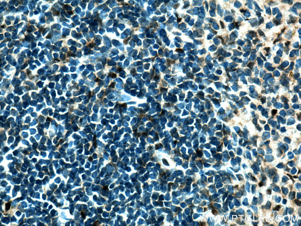 Immunohistochemistry (IHC) staining of mouse spleen tissue using ZBTB8OS Polyclonal antibody (28608-1-AP)