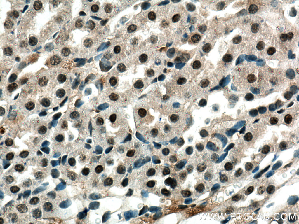 Immunohistochemistry (IHC) staining of mouse kidney tissue using ZBTB8OS Polyclonal antibody (28608-1-AP)