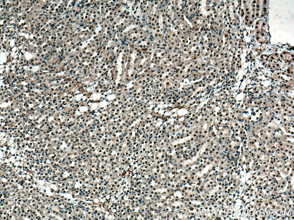 Immunohistochemistry (IHC) staining of mouse kidney tissue using ZBTB8OS Polyclonal antibody (28608-1-AP)