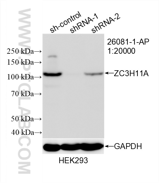Western Blot (WB) analysis of HEK-293 cells using ZC3H11A Polyclonal antibody (26081-1-AP)