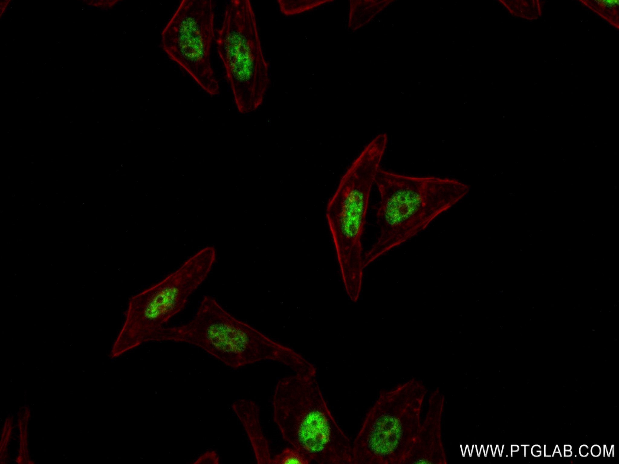 Immunofluorescence (IF) / fluorescent staining of HepG2 cells using ZC3H11A Recombinant antibody (82912-5-RR)