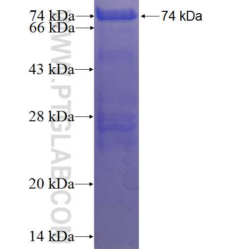 ZC3H11A Fusion Protein Ag23424 | Proteintech