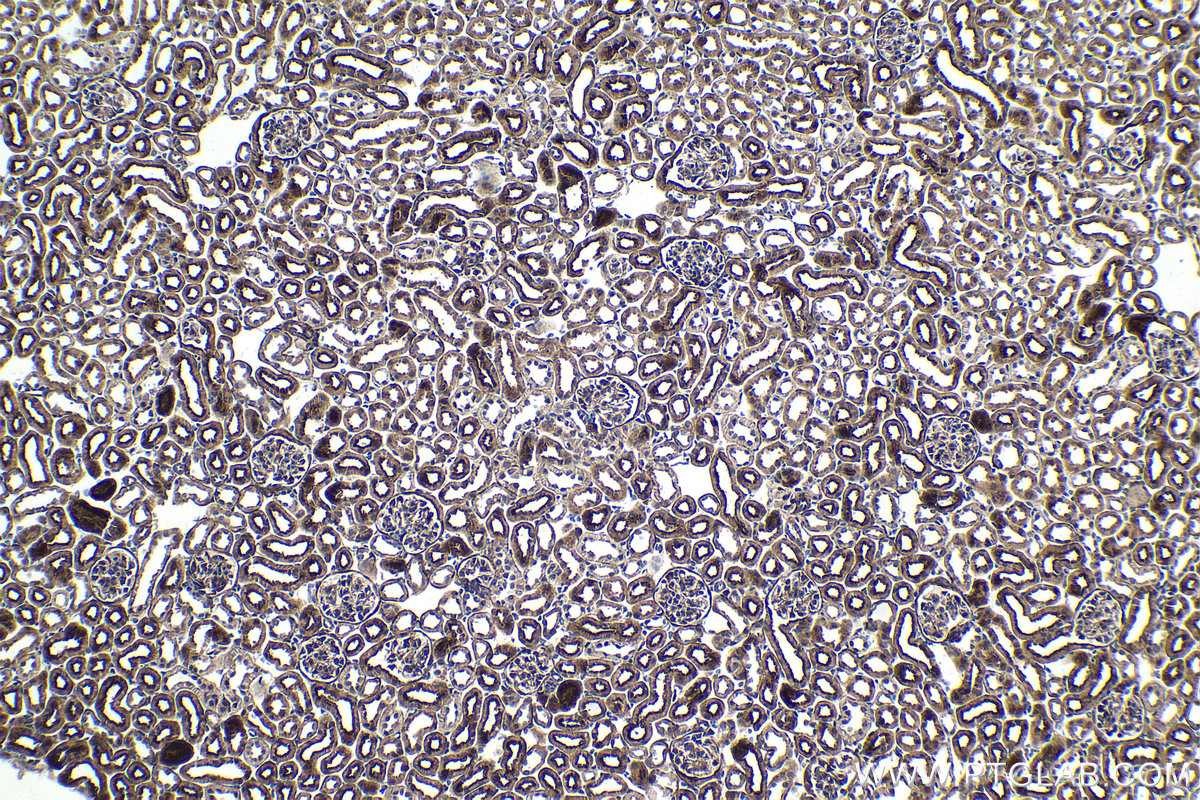 Immunohistochemistry (IHC) staining of mouse kidney tissue using ZC3H12A Polyclonal antibody (25009-1-AP)